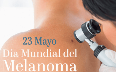 Programa 178 de Radio la Madraza: Día Mundial del Melanoma